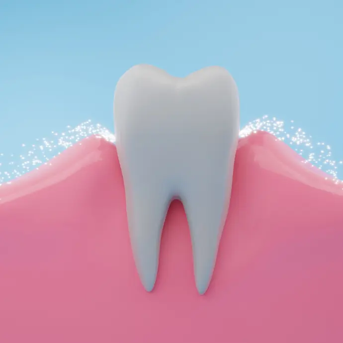 Cavity Prevention Treatment